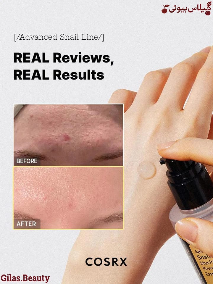 اسنس حلزون کوزارکس (100 میل) اورجینال