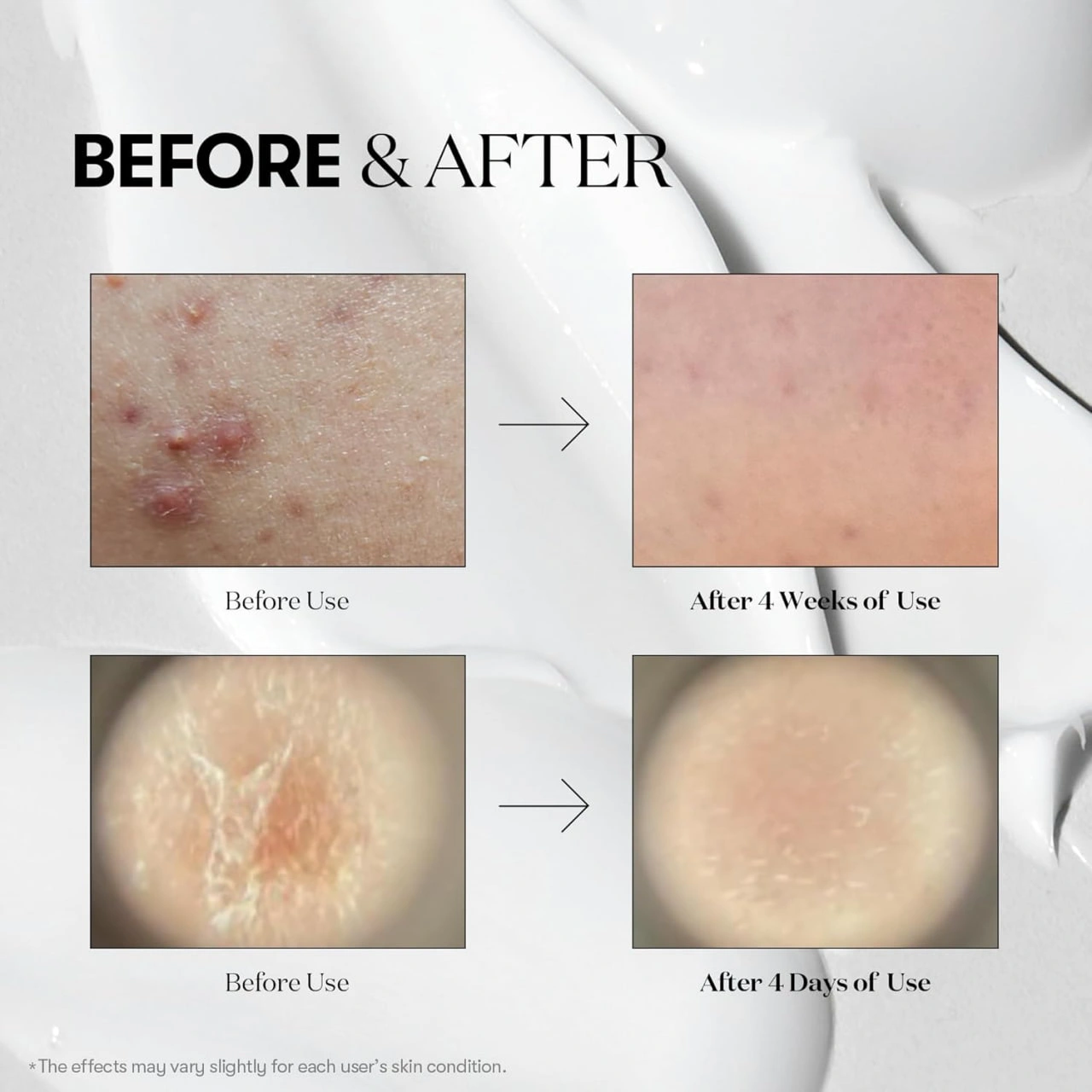 خرید و قیمت سرم ریدل شات ۱۰۰ وی تی میکرونیدلینگ محصول اصل کرهای 50mil